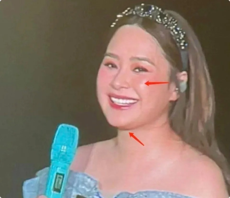 Đây thực sự là Chung Hân Đồng hậu phát tướng gây sốc, đột ngột tăng đến 75 kg