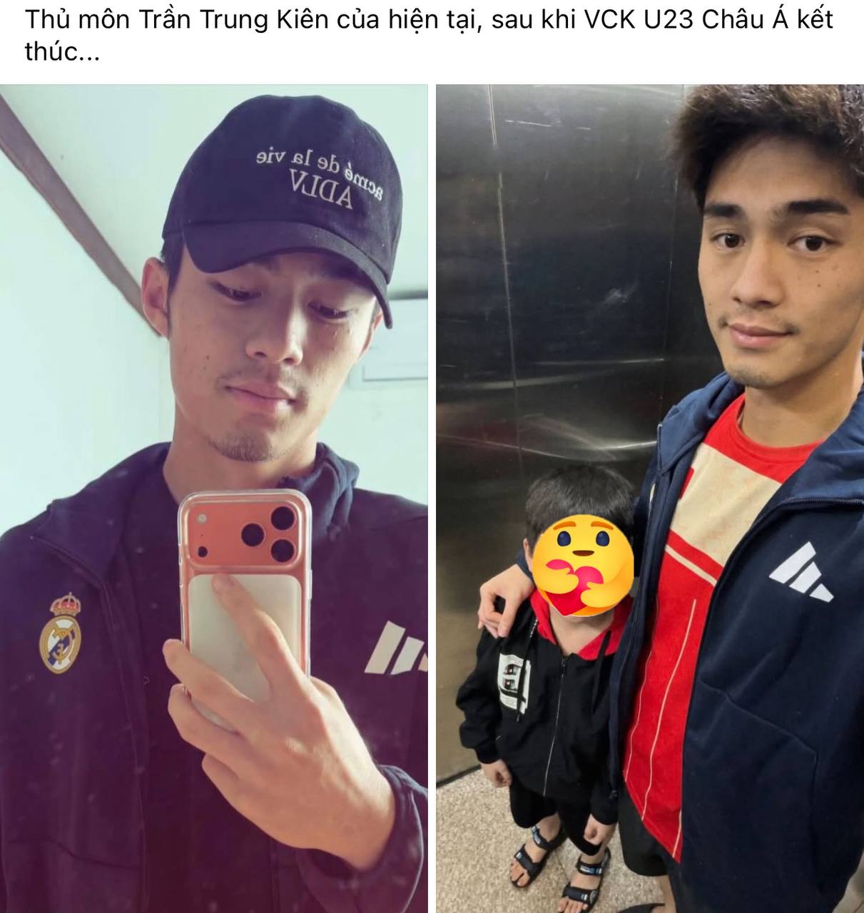 Dụi mắt không nhận ra thủ môn Trung Kiên